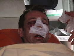 Öğretmeni öldüresiye dövdüler