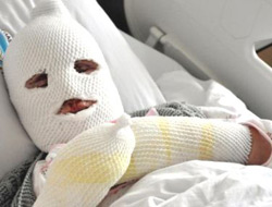 Tüpü açık unutunca...