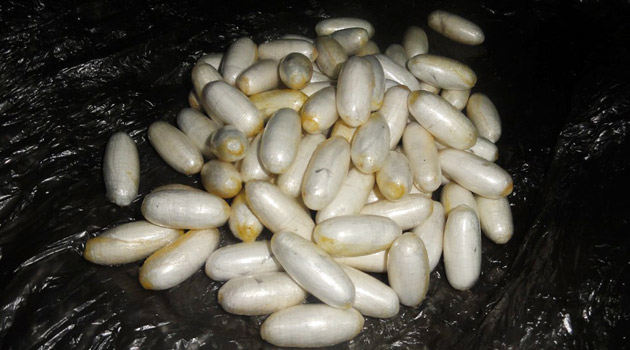 Hamile kadından bunlar çıktı