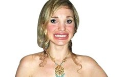 Güzelleşeyim derken bu hale geldi