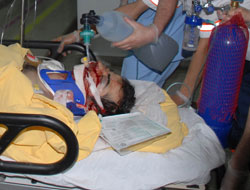 Samsun'da ağır yaralı genç öldü