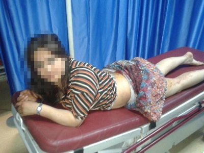 Karısını Kalçasından Bıçakladı