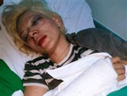 Eski Eşini Öldüresiye Dövdü