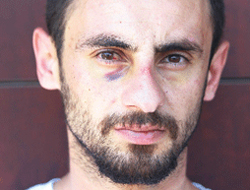 Polis dayağı öldürüyordu