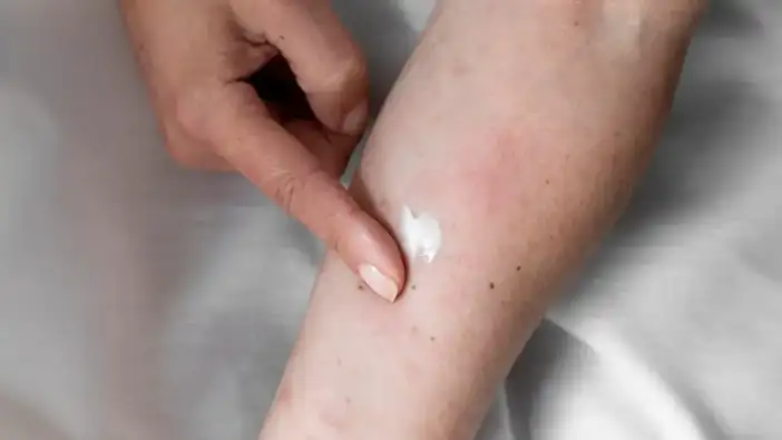 Trabzon’dan kışın artan yanık vakalarına karşı hayati uyarı