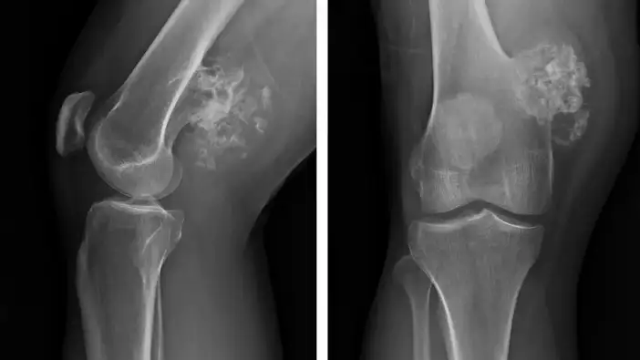 KTÜ’den kritik uyarı: Geç kalmayın