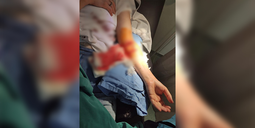 Samsun'da iki köpeğin saldırdığı anne-kız ucuz kurtuldu