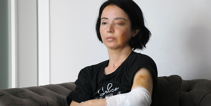 Samsun'da iki köpeğin saldırdığı anne-kız ucuz kurtuldu