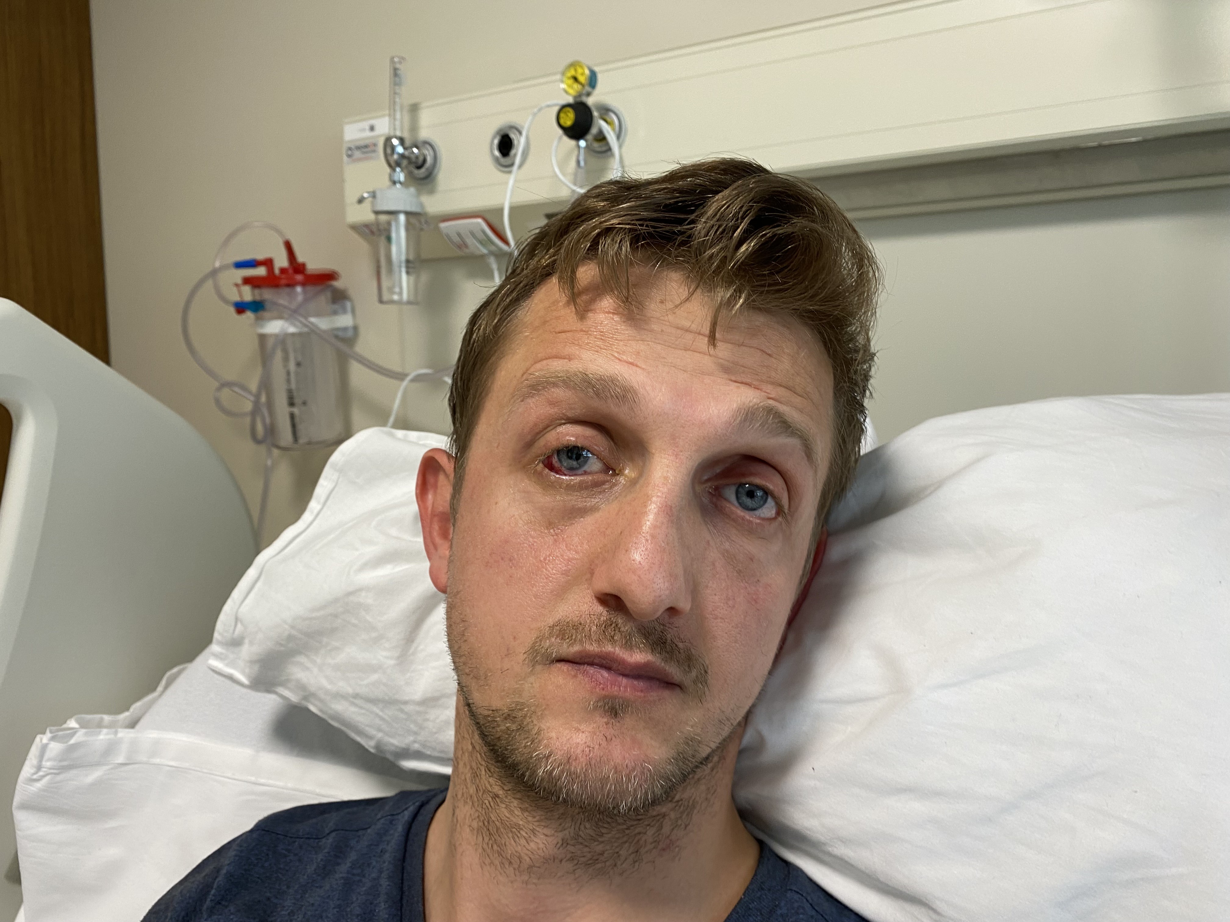 Evinde tadilat yapmak isteyen Rizeli vatandaş gözünden oluyordu