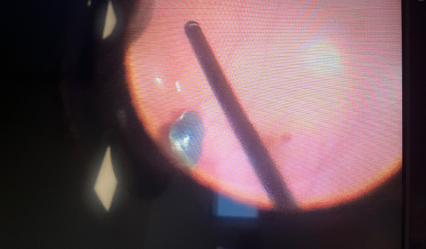 Evinde tadilat yapmak isteyen Rizeli vatandaş gözünden oluyordu