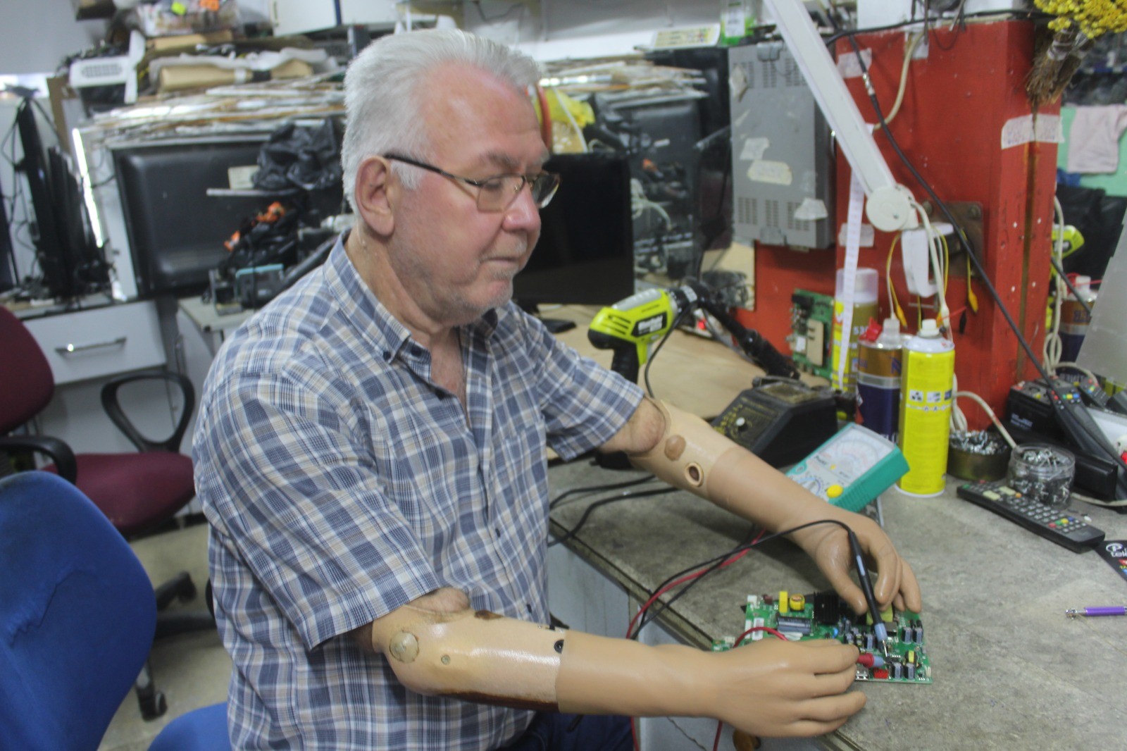 Giresun'da kazada kollarını kaybetti ama yaşam azmini kaybetmedi