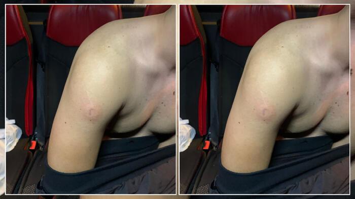 Trabzonspor Basel maçı sponrası-3