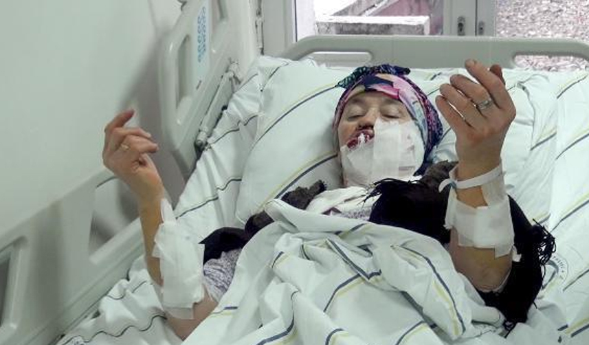 Erzurum'da köye kurt indi! 5 kişiyi yaraladı