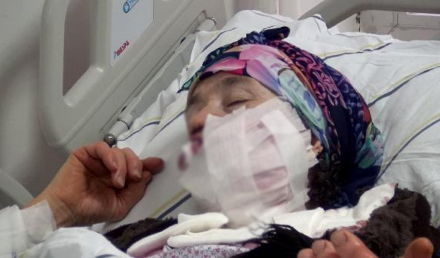 Erzurum'da köye kurt indi! 5 kişiyi yaraladı