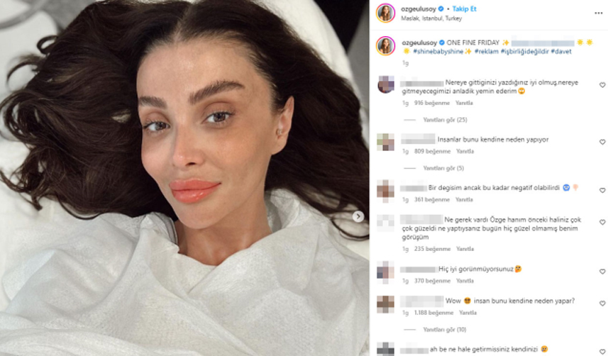 Babasının ölümünden sonra bir deri bir kemik kalmıştı! Son hali şaşırttı