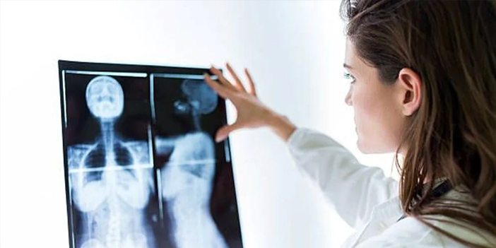 Meme kanserine yapay zeka tedavisi