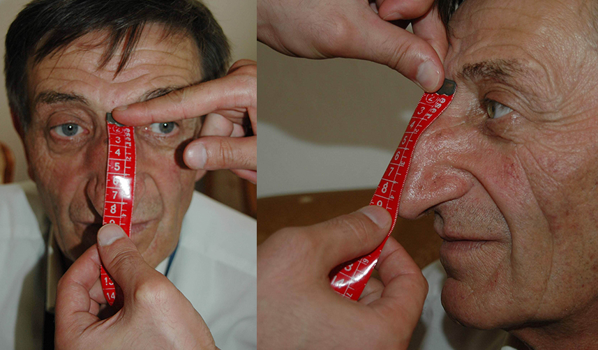 Artvinli dünyanın en uzun burunlu adamı Mehmet Özyürek'ten acı haber 