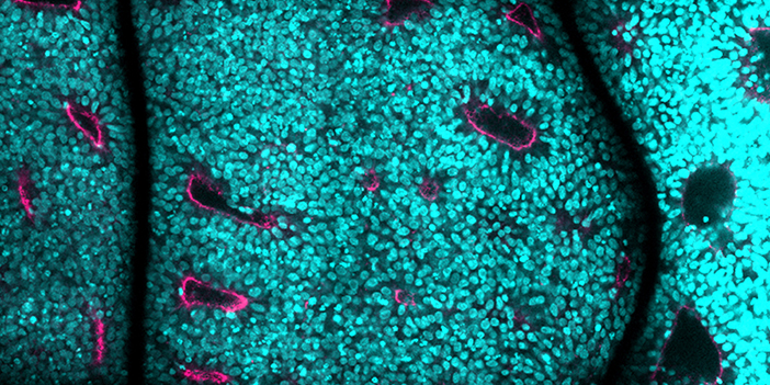 Dünyayı etkileyen hastalığa KTÜ'den ümit ışığı