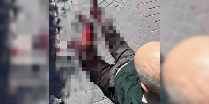 Başıboş bırakılan Pitbull yaşlı adamı feci yaraladı