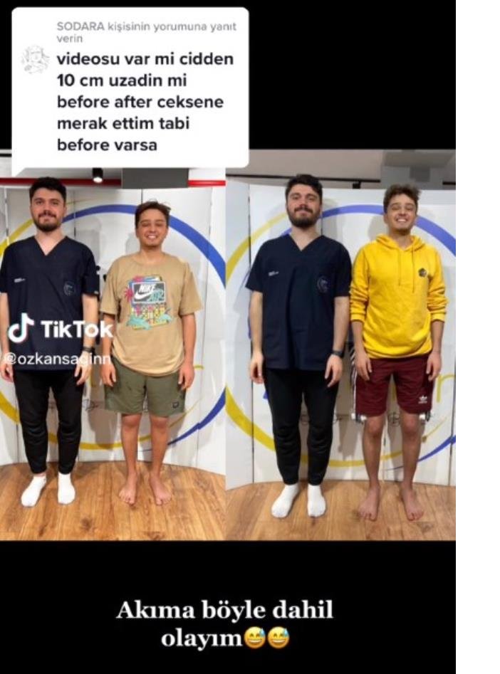 tiktok-fenomeni-ozkan-sagin-boy-uzatma-ameliyati-oldu3.jpg