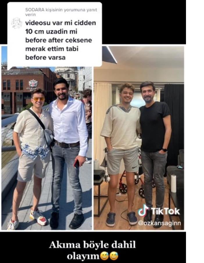 tiktok-fenomeni-ozkan-sagin-boy-uzatma-ameliyati-oldu4.jpg
