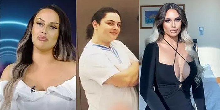 Kısmetse Olur'un gelin adayı Yaren'in estetiksiz eski hali ortaya çıktı!