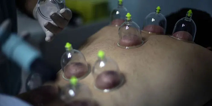 Oruç tutarken hacamat yaptırmak orucu bozar mı? Oruçluyken hacamat yaptırmak orucu bozar mı?