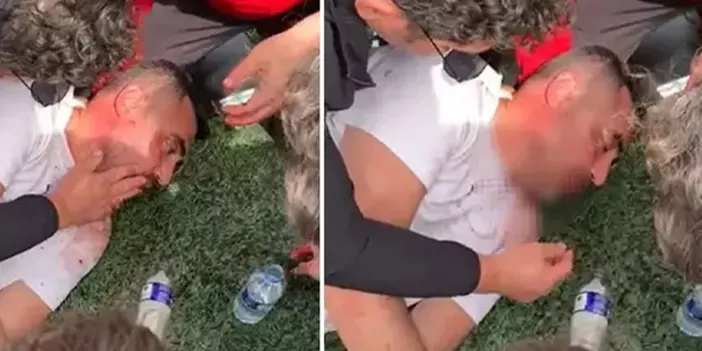 U17 karşılaşmasında korkutan anlar! Teknik direktör ölümden döndü