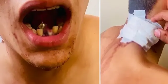 İstanbul'da maganda kurşununun hedefi oldu! Boynundan girdi çenesine saplandı 