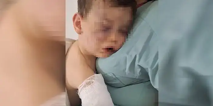 Sigara Yanıkları ve Darp İzleri… Aren Bebeğin Davasında Anne İçin Tutuklama Talebi!