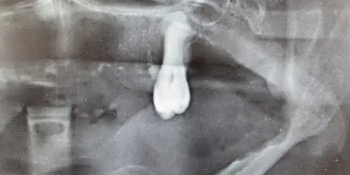 samsunda-dis-hekimi-konustu