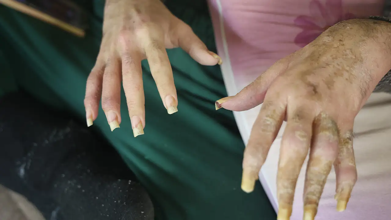 hatayda-evden-cikmayan-genc