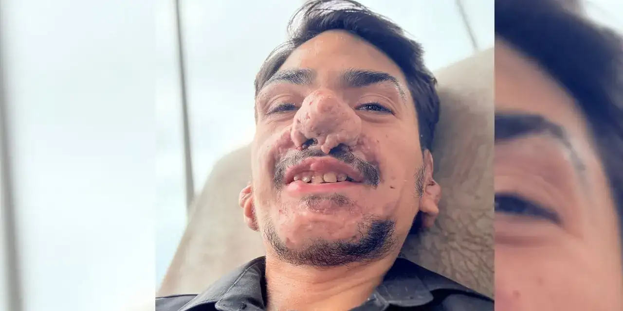 haydarcan-zorlu-yasam-mucadelesi