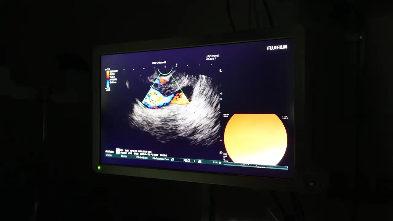 trabzonda-saglikta-yeni-donem-kanuni-hastanesinde-eus-uygulamasi-basladi