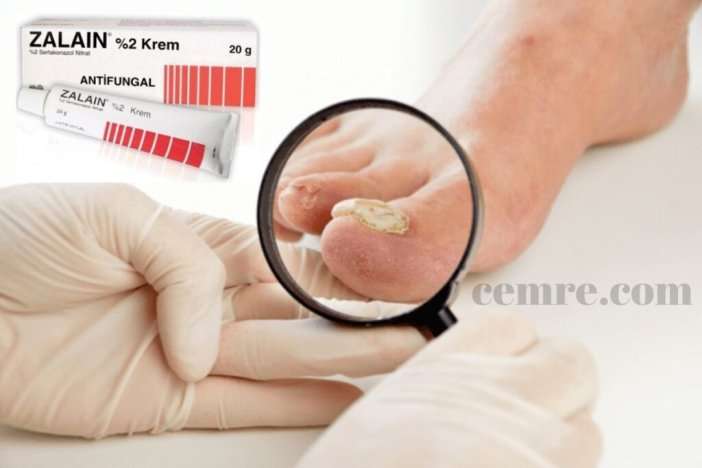 zalain-krem-nedir-ne-ise-yarar-nasil-kullanilir-fiyati-ne-kadar
