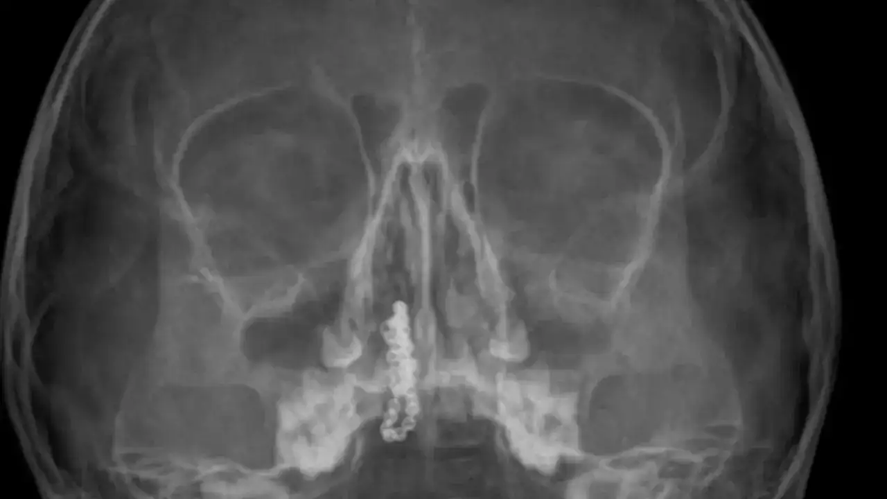 brnunda-yasamis-5-yil