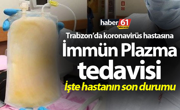 Prof. Dr. Yüksek Aliyazıcıoğlu Haber61’e konuştu! “Trabzon’da koronavirüs hasta sayısı stabilleşti”