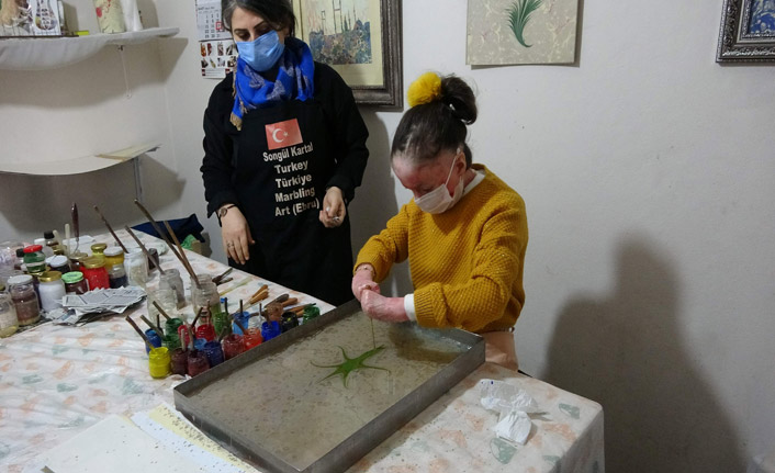 Kelebek hastası Trabzonlu Ayşenur ebru sanatına tutundu