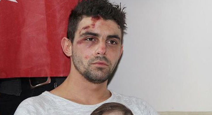 Hollanda polisinin köpekle saldırdığı Trabzonlu o anları anlattı