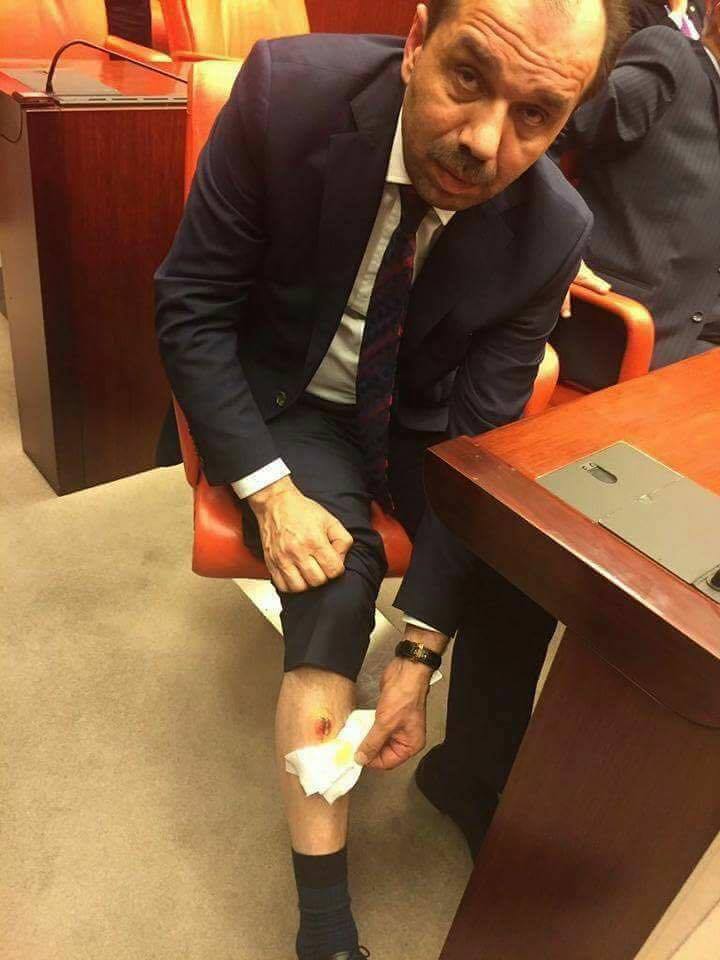 AK Parti Trabzon Milletvekili Mecliste Bacağından ısırıldı!