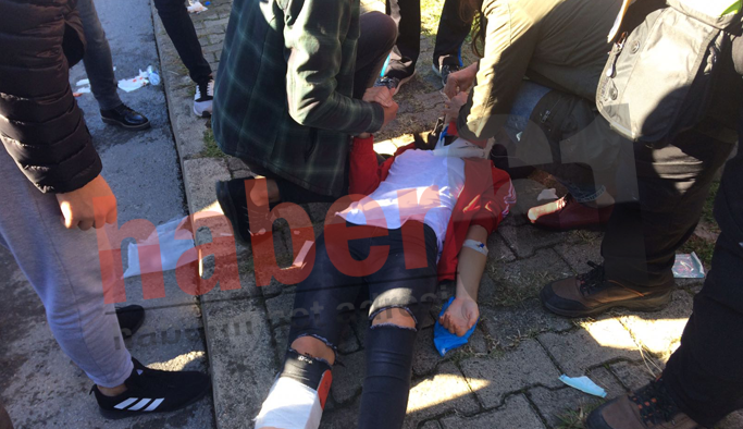 Trabzon'da öğrencilere motor çarptı: 6'sı öğrenci 7 yaralı