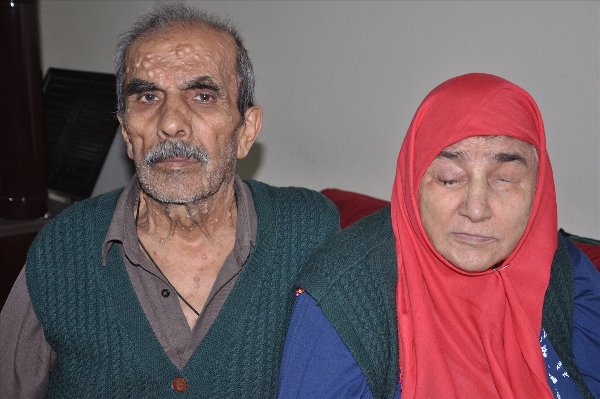 Trabzon 40 yıldır eşinin gözü oluyor