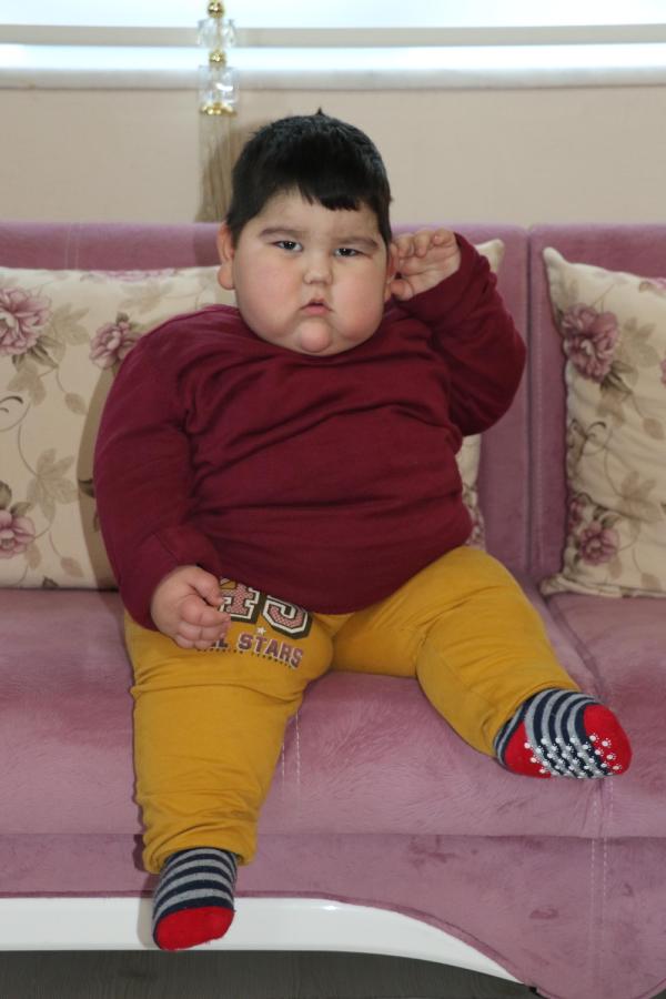 2 yaşında 37 kiloluk Yağız, devlet desteğiyle kilo vermeye başladı