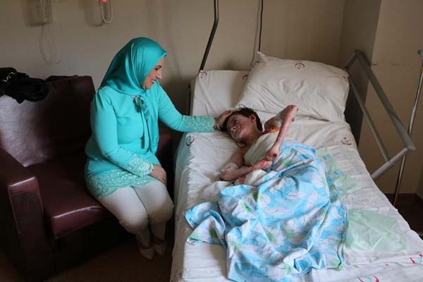 Trabzon'da “Kelebek hastası” Elif'e umut oldular