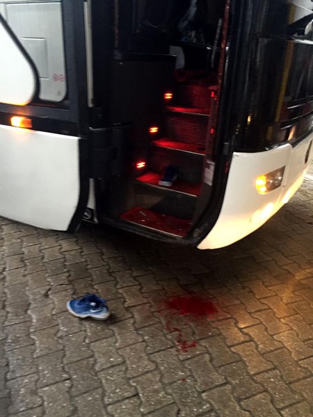 Afyonspor otobüsüne taşlı saldırı! Sportif Direktör İbrahim Çelik ağır yaralı