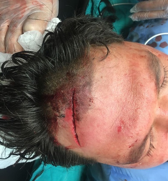 Hasta yakını doktorun kafasında parke taşı parçaladı! 