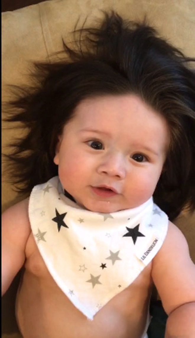 7 aylık bebeğin saçlarını gören peruk sanıyor